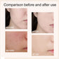 🎁Last Day Promotion buy 1 get 1 free🔥Skin Tone Adjusting CC Cream SPF 43