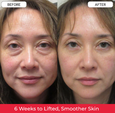 2026 Women's Month SaleBuy 1 Get 1Free/Korean Anti-Aging Cream