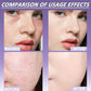 🔥 Buy 1 Get 1 Free🔥Professional Soft Matte Cream Concealer Foundation｜Brighten Dark Circles, Crease