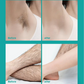 🔥Buy 1 Get 1 Free🔥Painless Full Body Hair Removal Cream for Men & Women– Skin-friendly for all areas🌿
